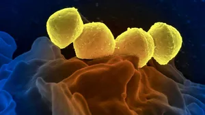 Mould, bacteria, toxins & ... shame
